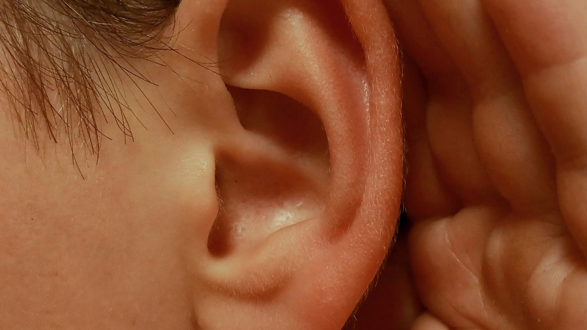 6. Les muscles qui font bouger les oreilles
