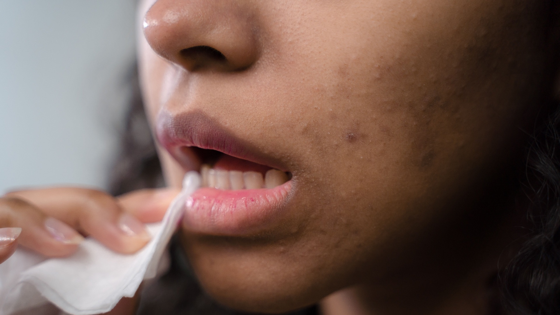1. Lorsque votre peau s'irrite facilement