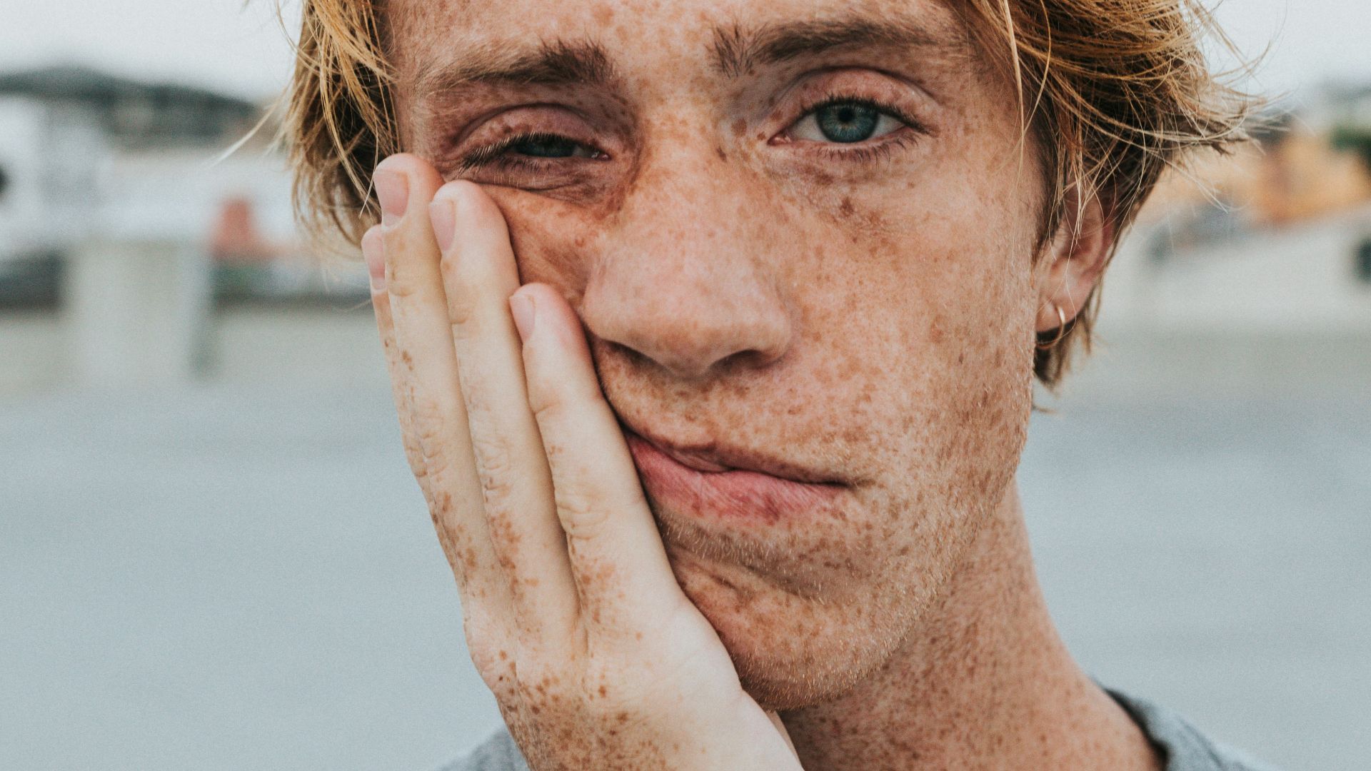6. Sa peau semble terne, même quand il est reposé