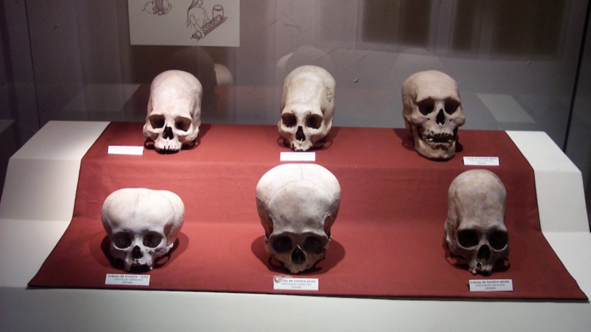 18. Modelage artificiel du crâne