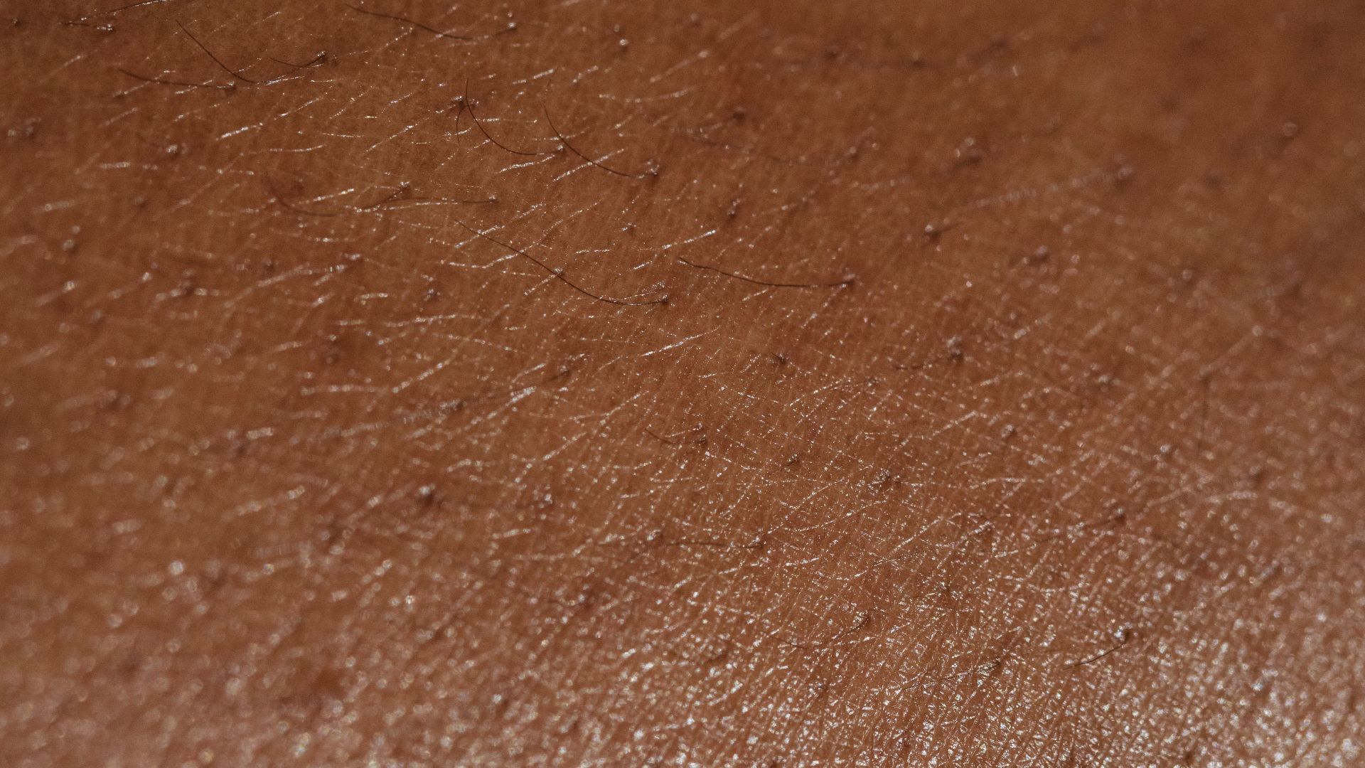 20. Il crée une surface légèrement acide