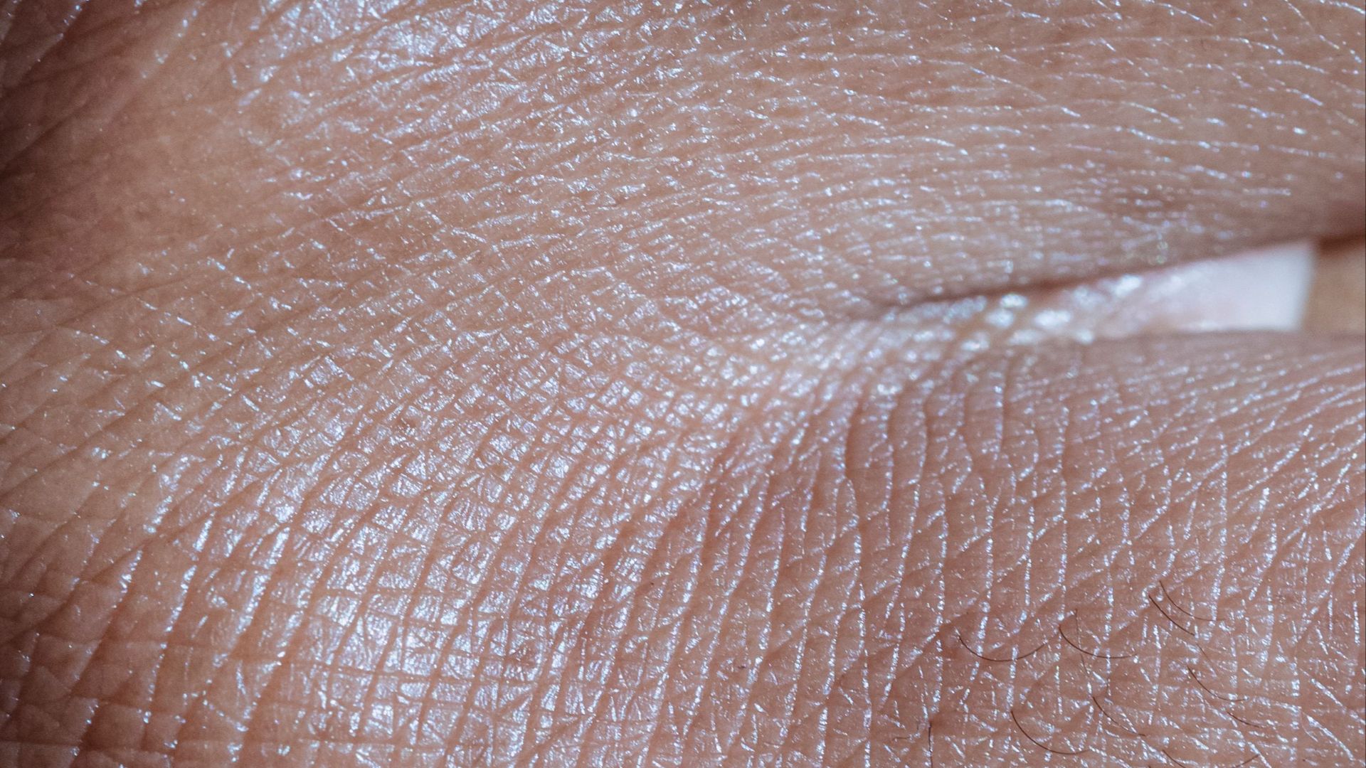 7. Votre peau est sèche