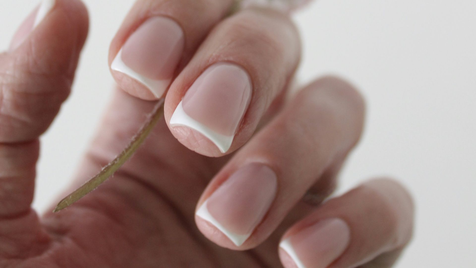 9. Ongles cassants ou en forme de cuillère
