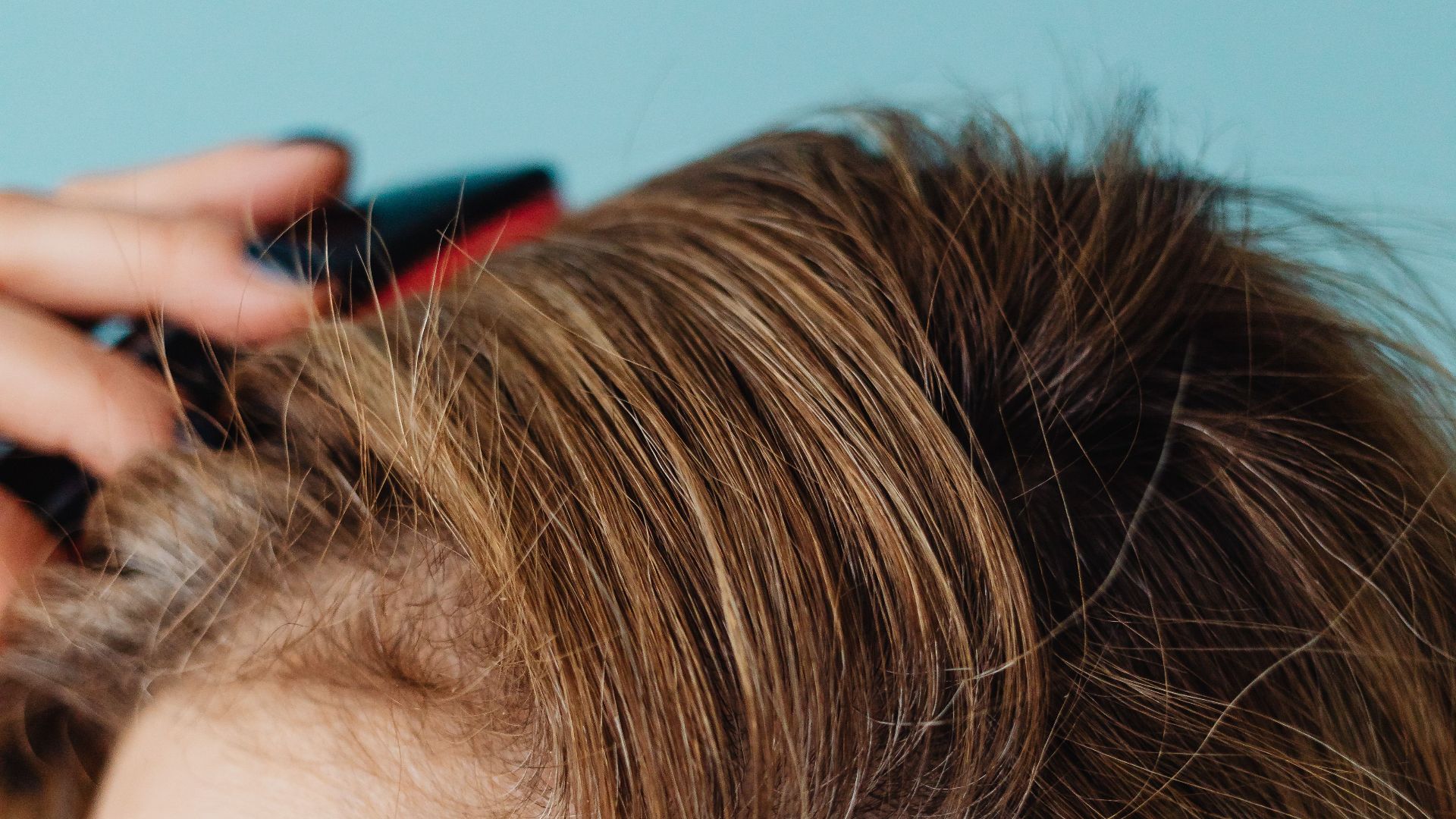 5. Vous avez des démangeaisons au cuir chevelu après vous être lavé les cheveux