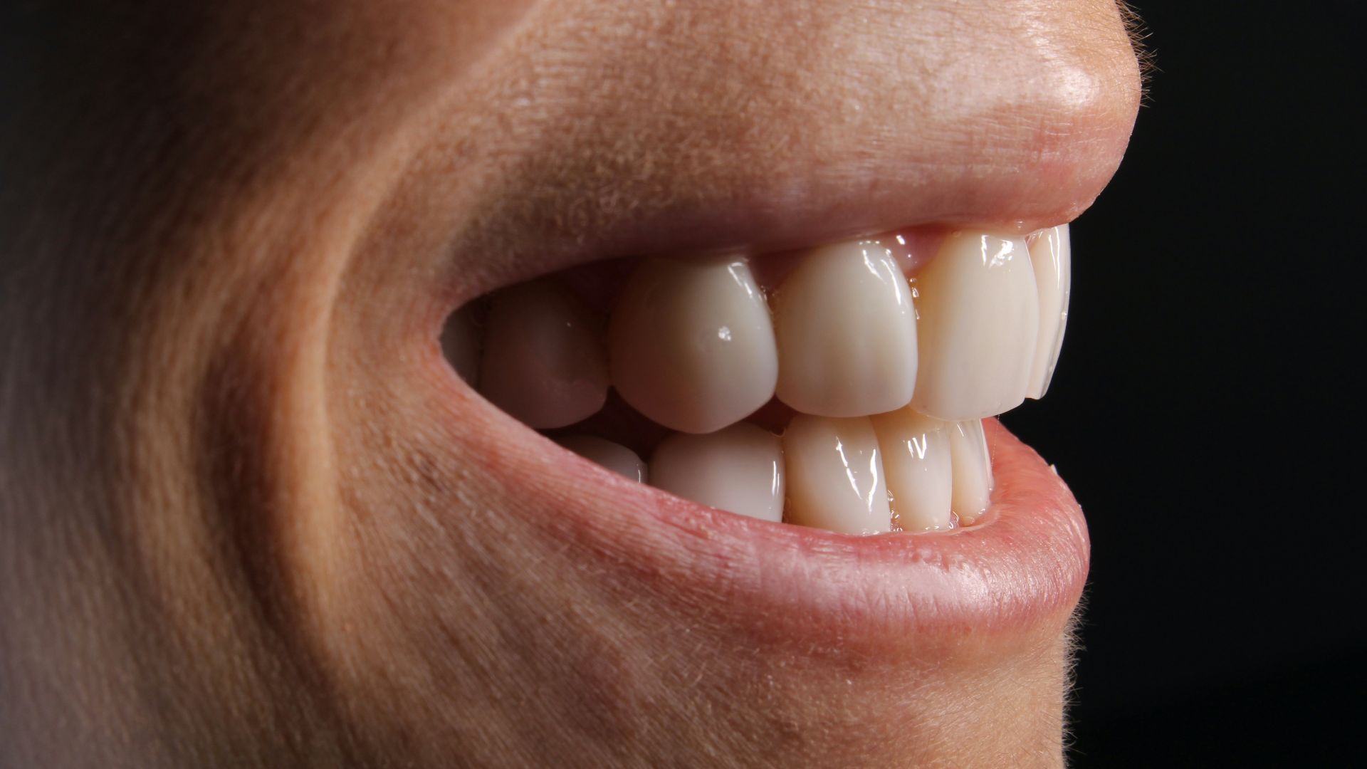 4. Si vous grincez des dents la nuit