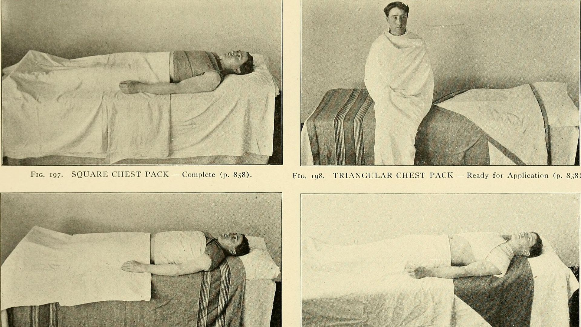 7. Draps froids et humides