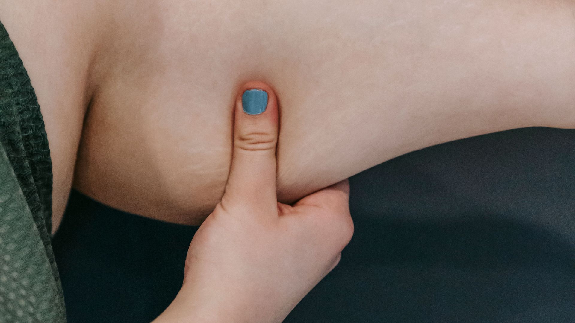 6. Votre peau reprend sa forme lorsque vous la pincez