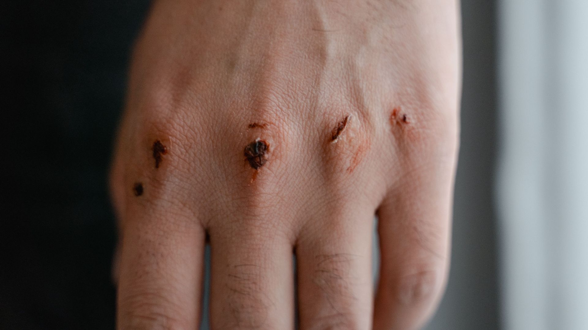 4. Il forme des croûtes sur les coupures