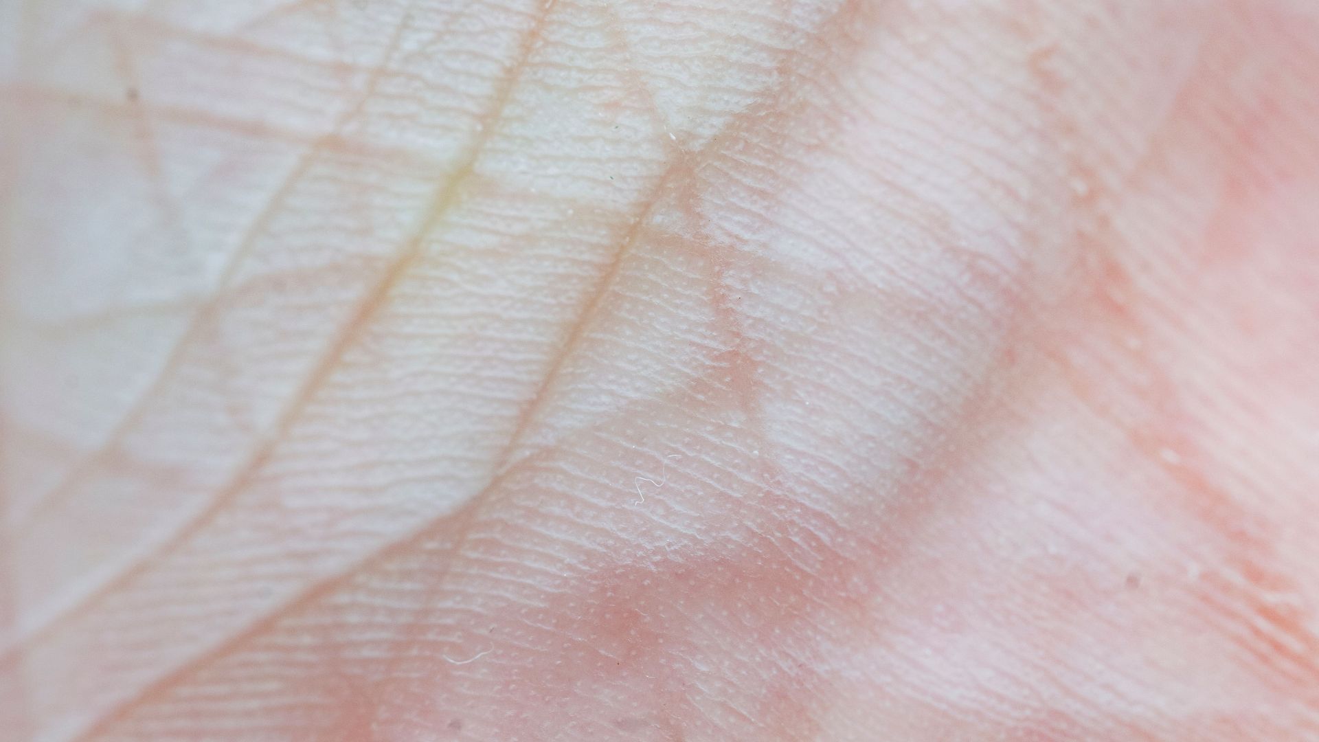 16. Elle élimine constamment les cellules mortes
