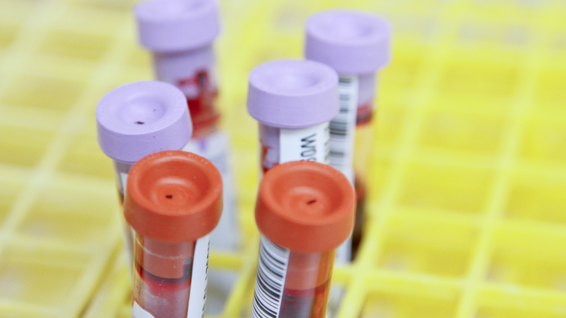 1. Prenez rendez-vous avec votre médecin pour faire un bilan sanguin