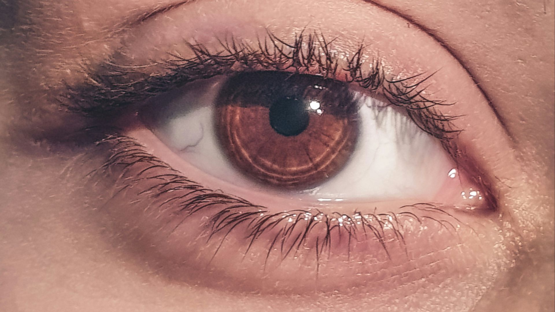 4. Dilatation directe de la pupille
