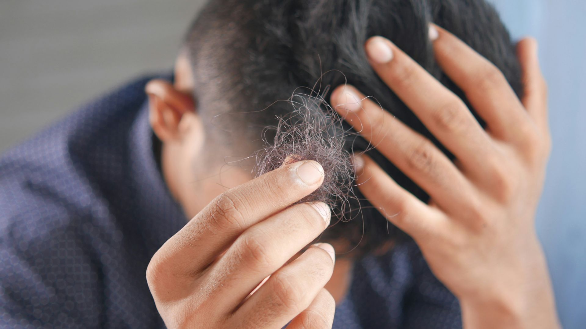 13. Minoxidil