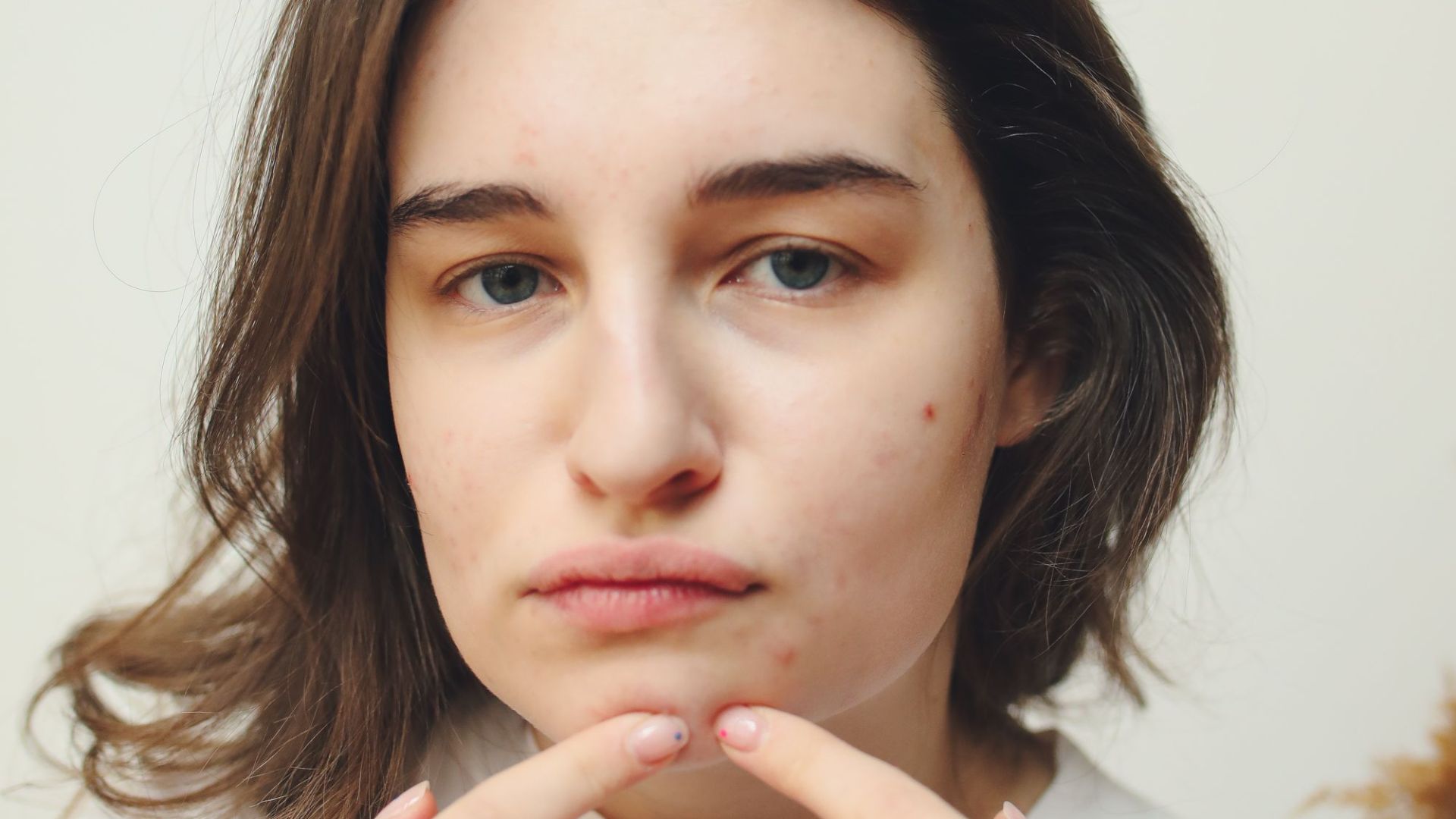 2. Si vous vous grattez la peau