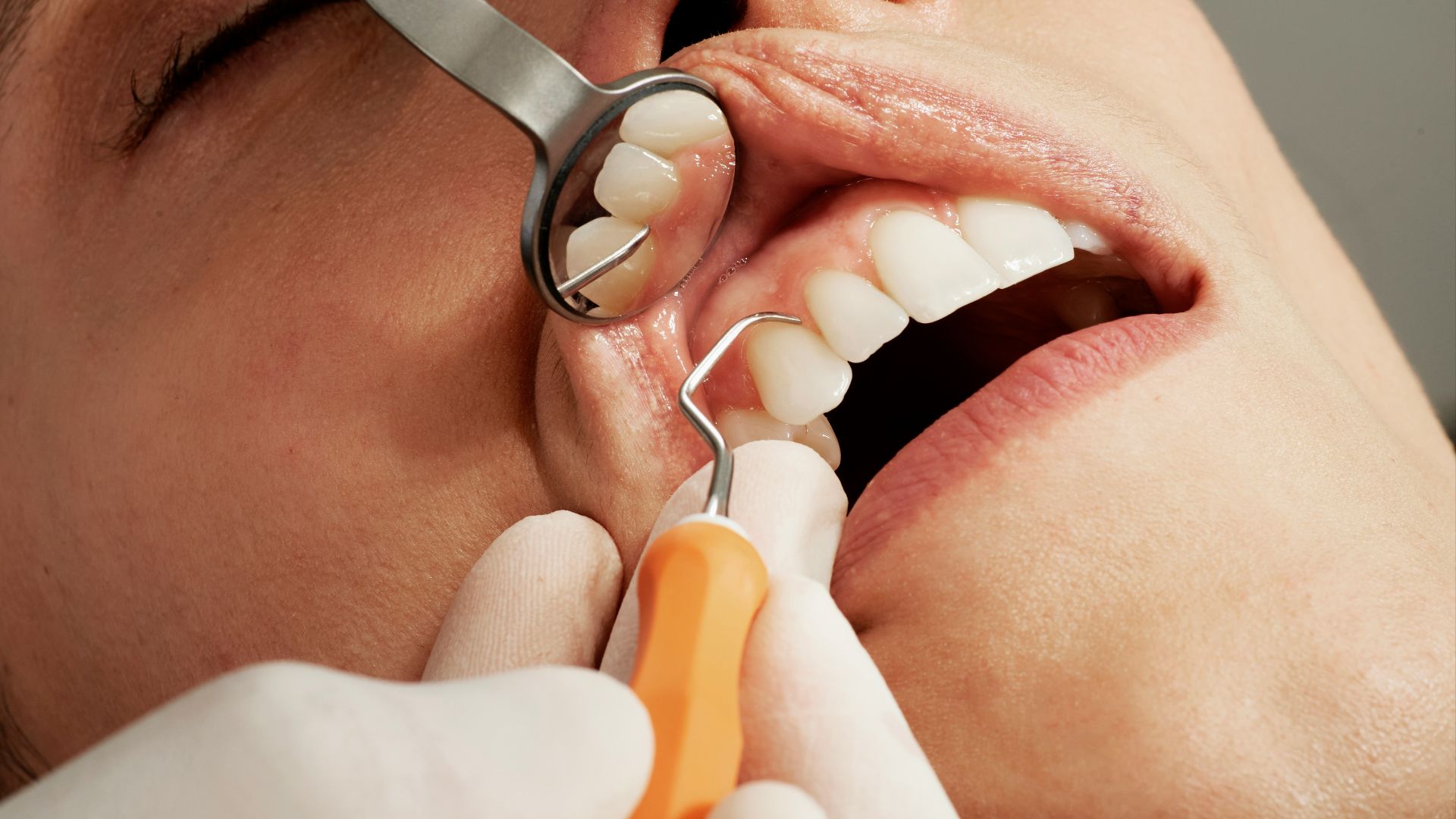 10. L'engouement pour les chewing-gums et les bonbons probiotiques