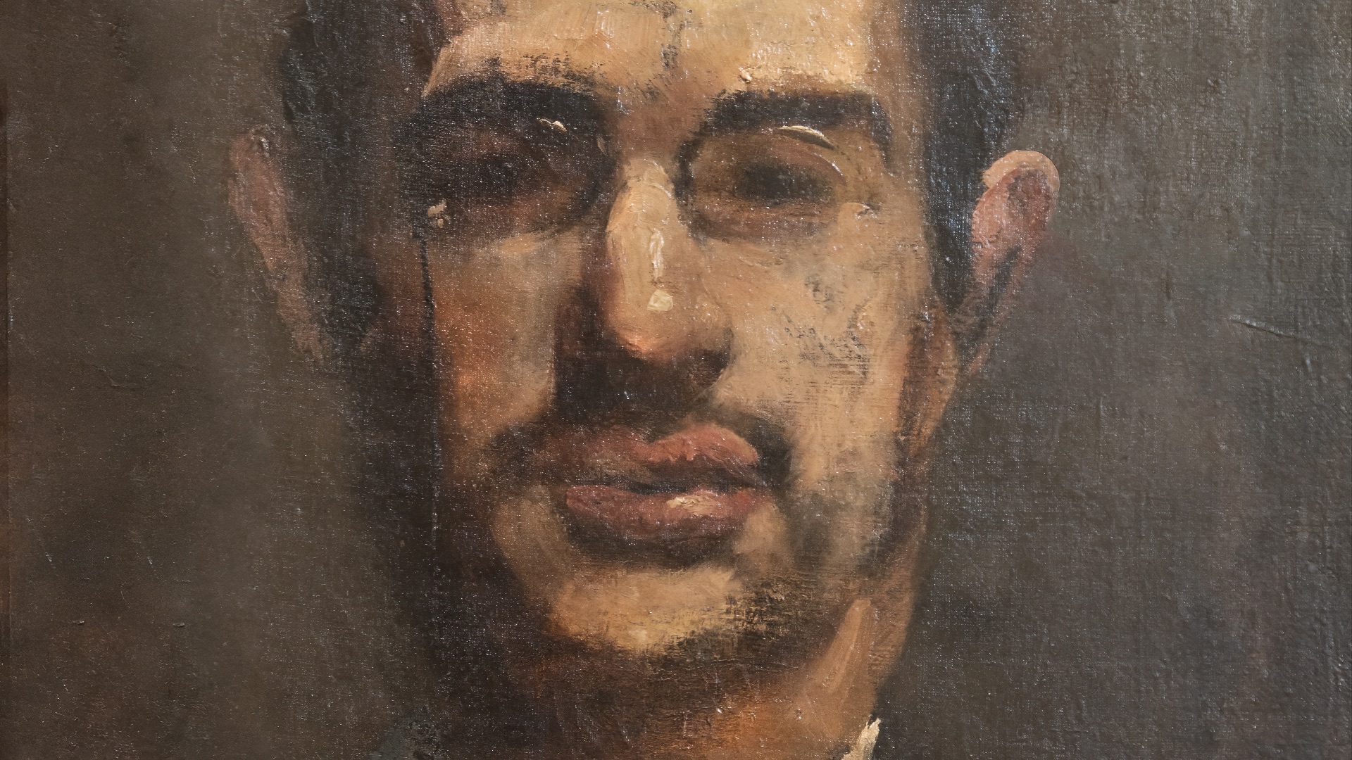 14. Henri de Toulouse-Lautrec : une maladie osseuse rare