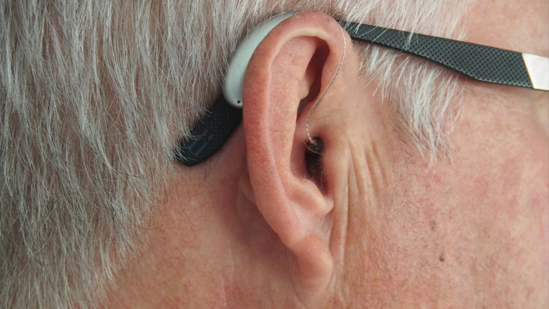 10. Modifications soudaines ou progressives de l'audition