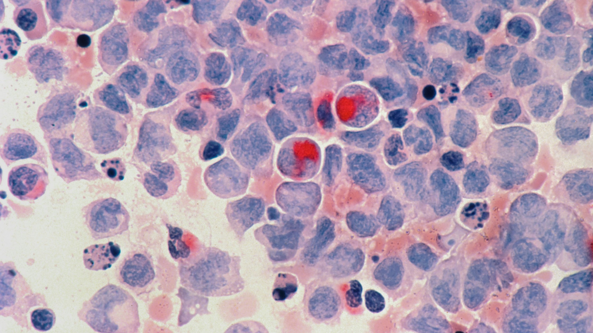 2. Il est capable de distinguer vos cellules des envahisseurs