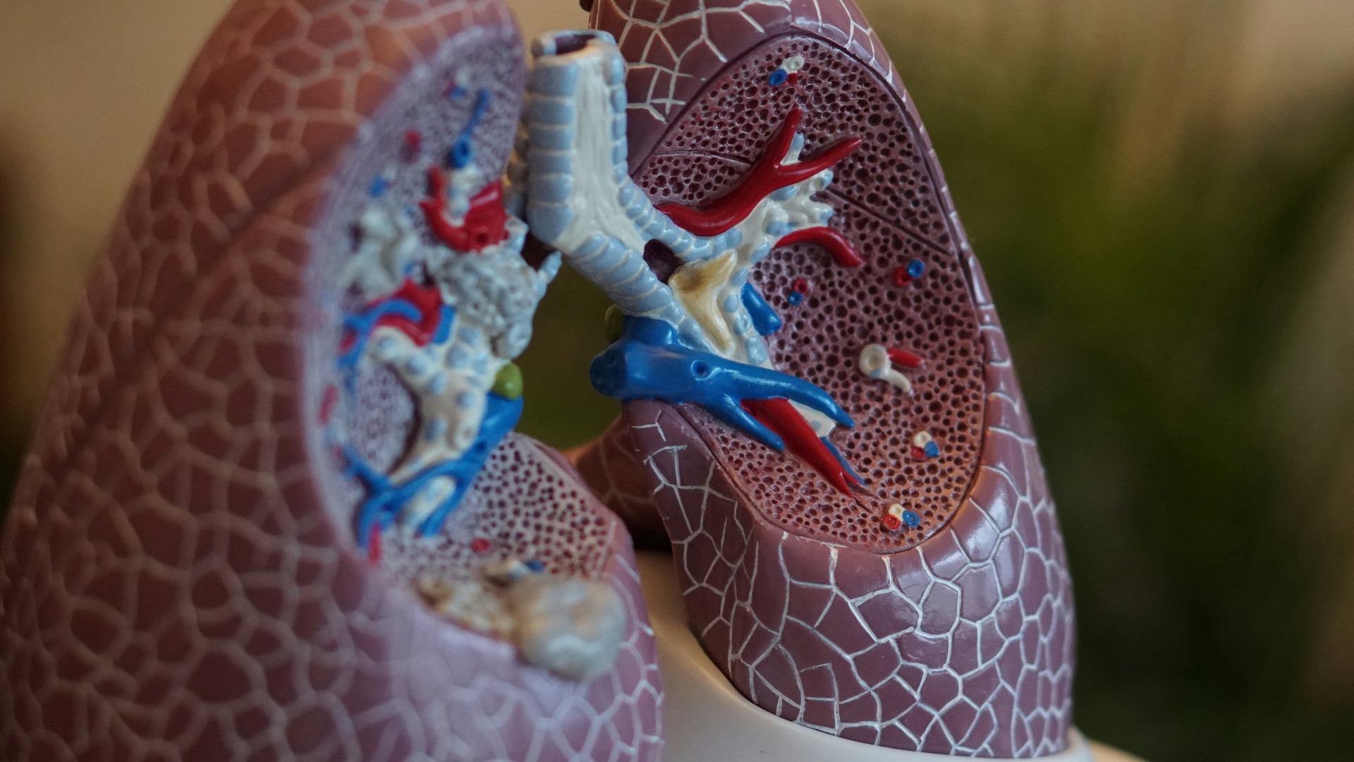 9. Maladie pulmonaire obstructive chronique (MPOC)