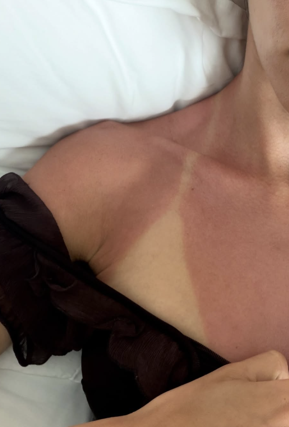 Watch out for the sun!