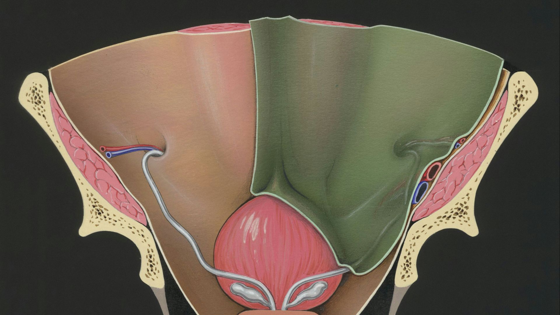 12. Les fuites urinaires deviennent plus perceptibles