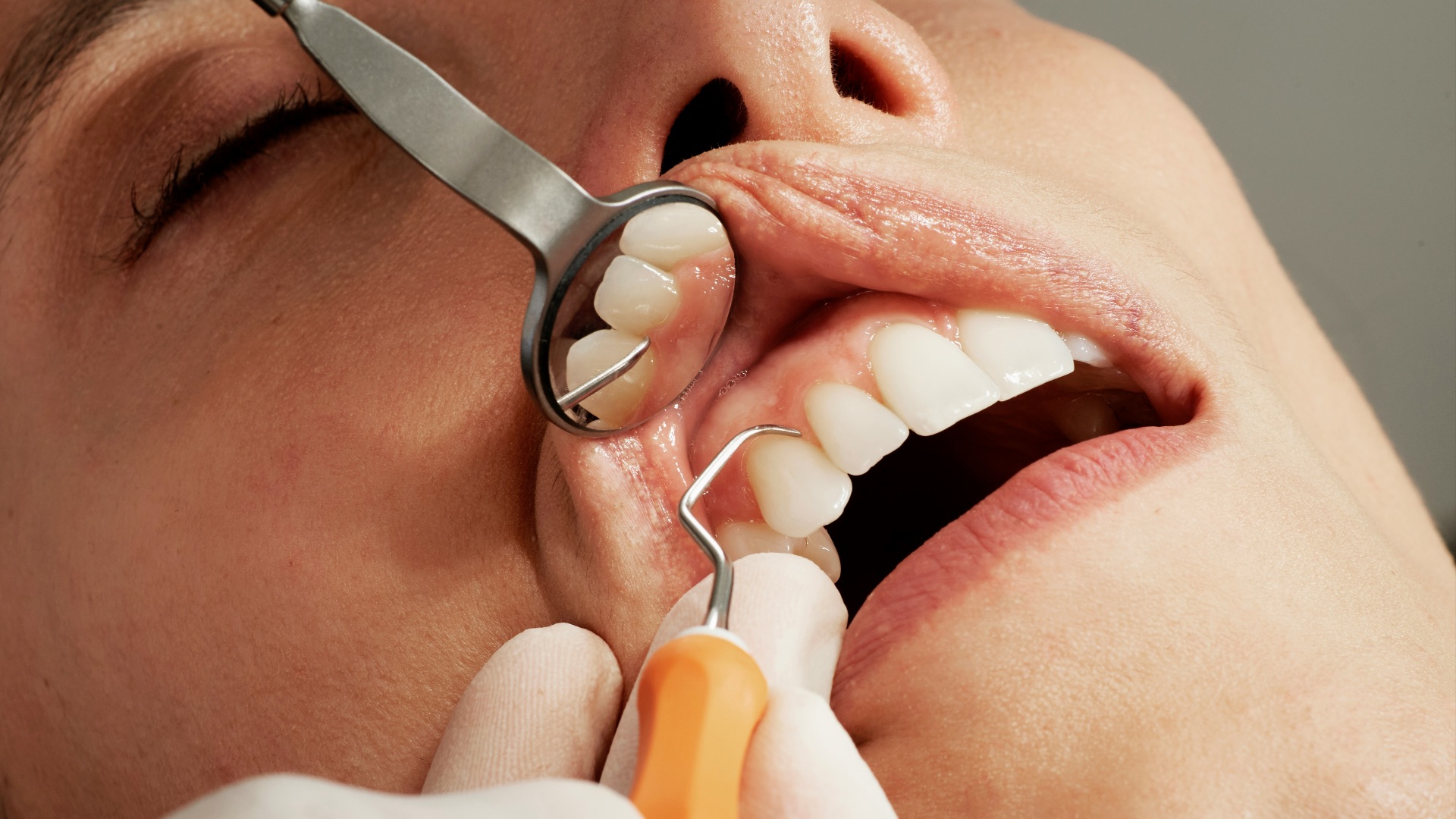 17. Ne négligez pas vos visites chez le dentiste même si vous n’avez pas mal