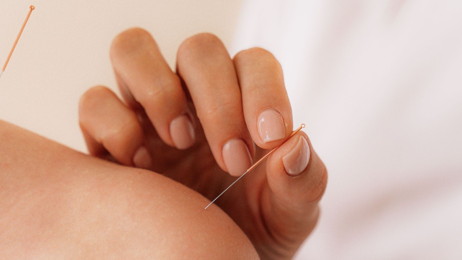 8. Acupuncture