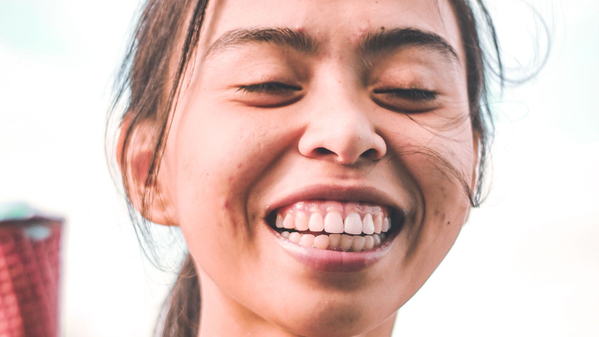 4. Les dents sont-elles visibles ou non ?
