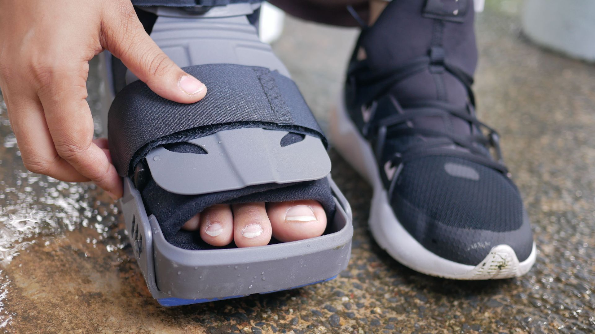 7. Vous avez subi plusieurs fractures