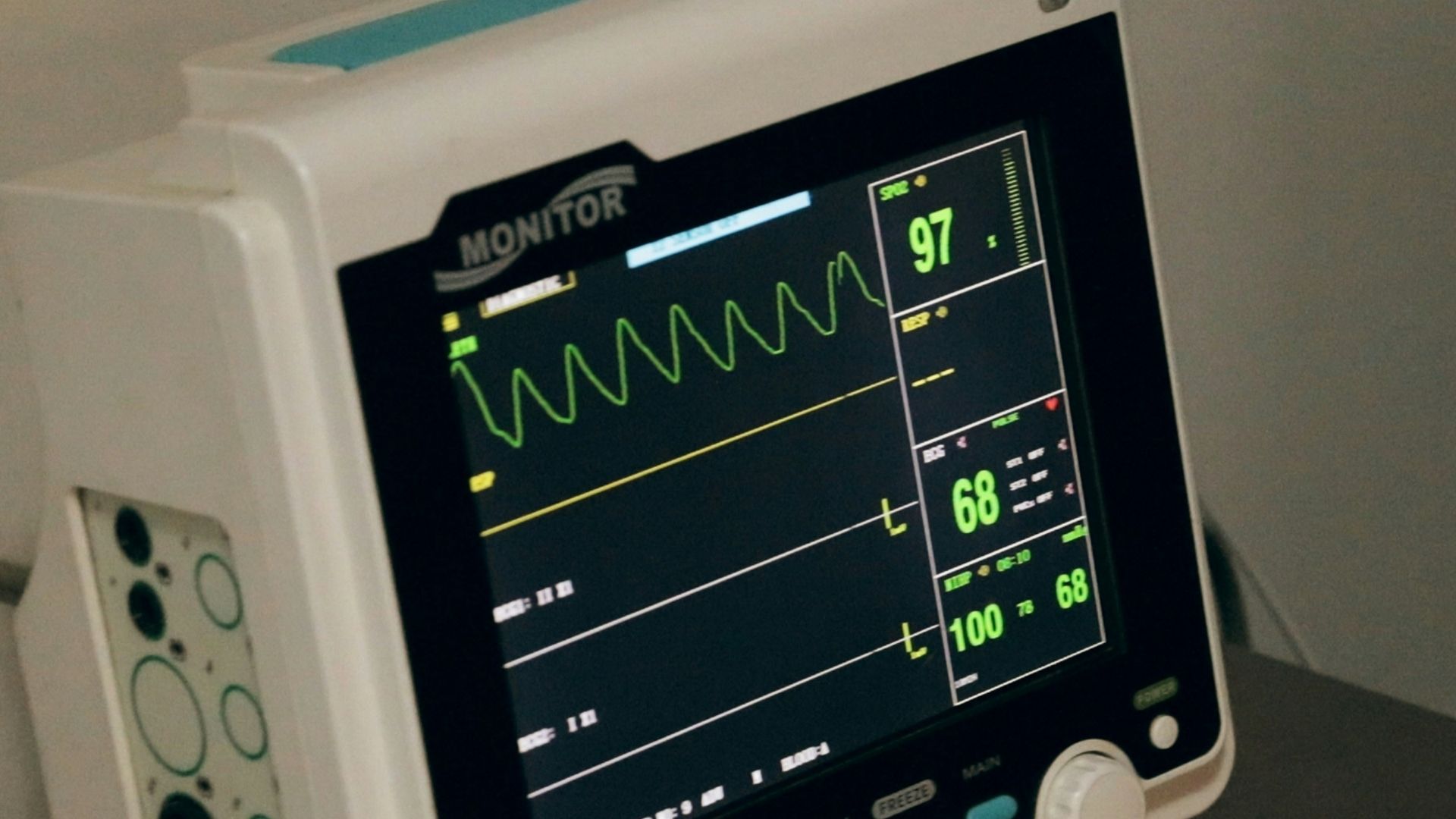 5. Rythme cardiaque inhabituel