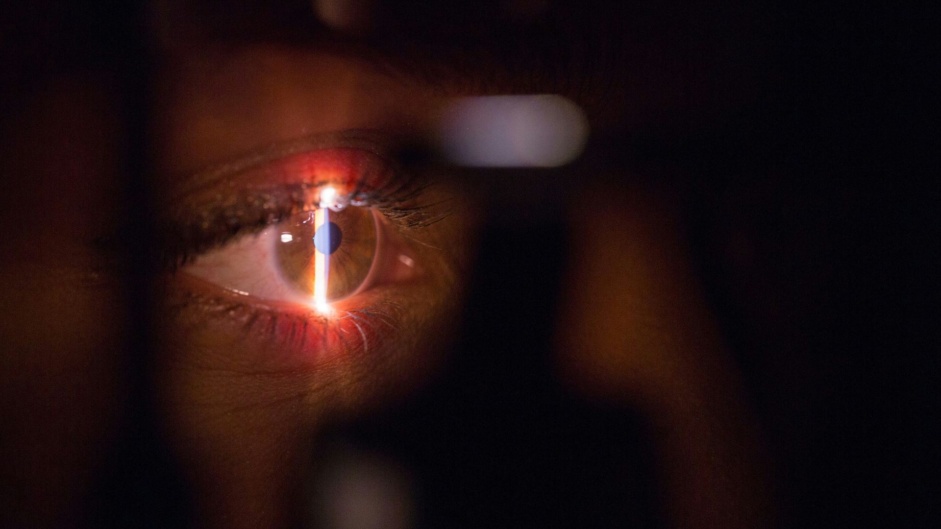 6. Test des doigts pour évaluer la vision périphérique
