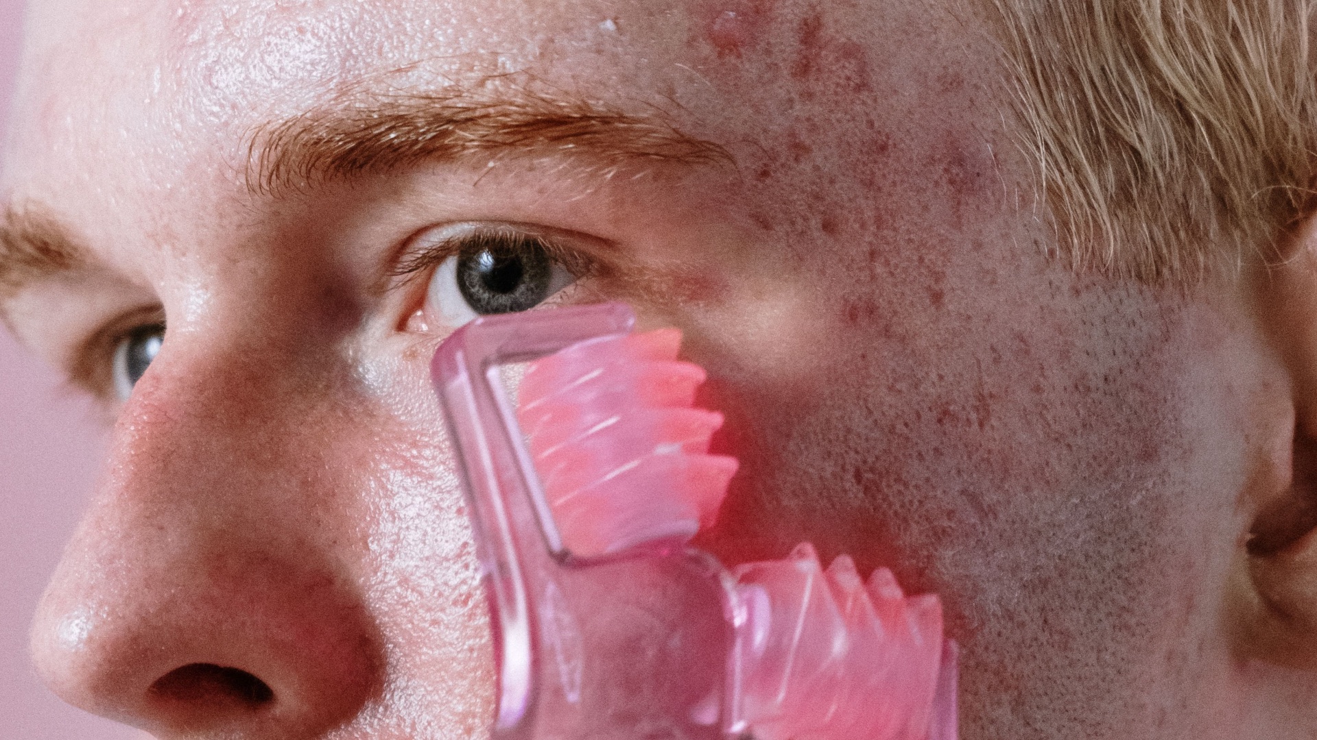5. Il faut d'abord que votre barrière cutanée soit en bonne santé