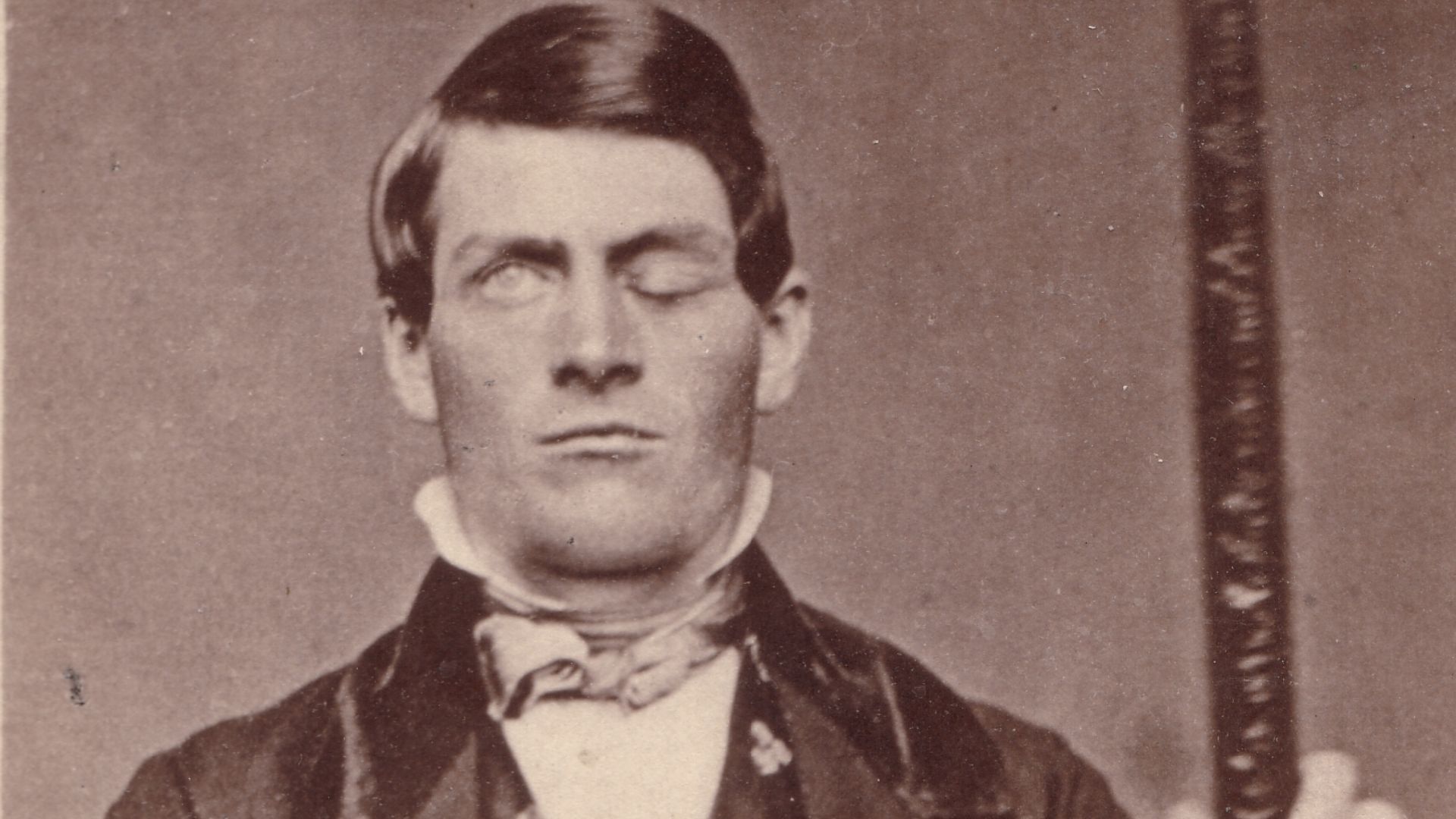 20. Phineas Gage
