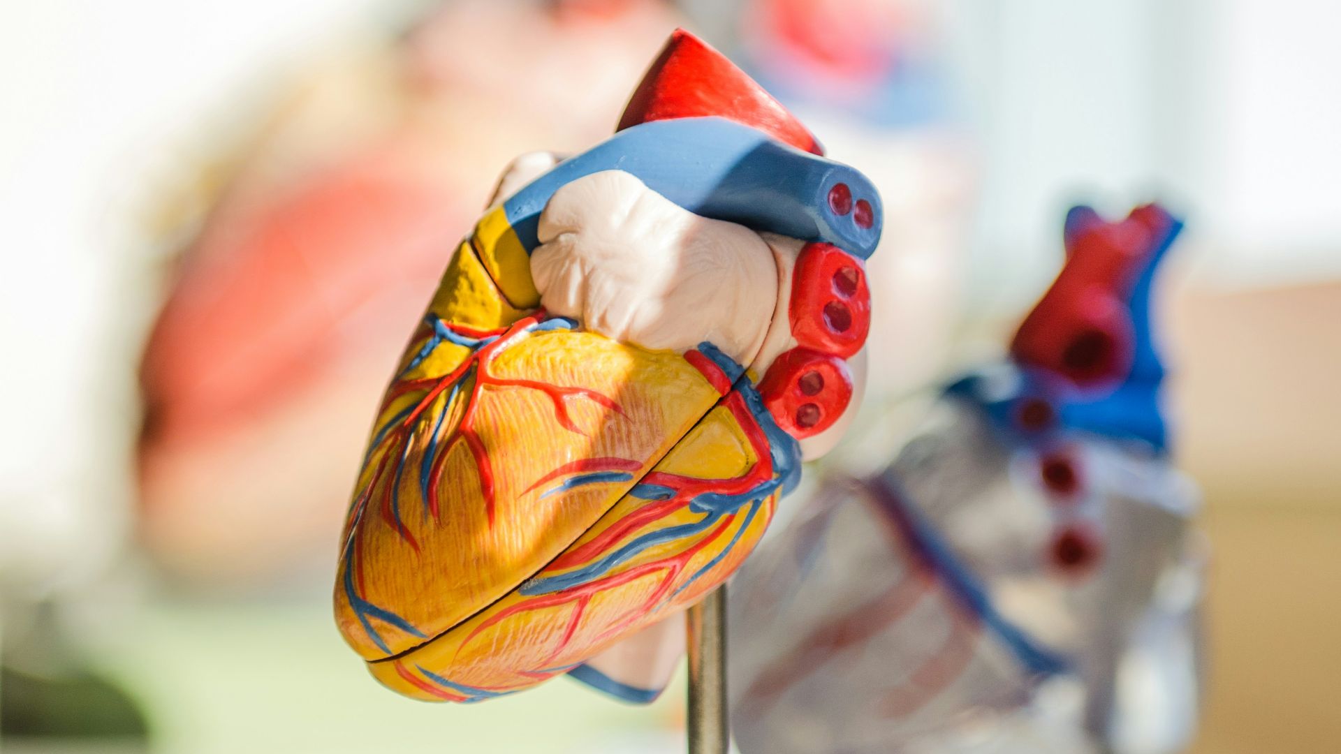 18. Il est associé à un risque cardiovasculaire