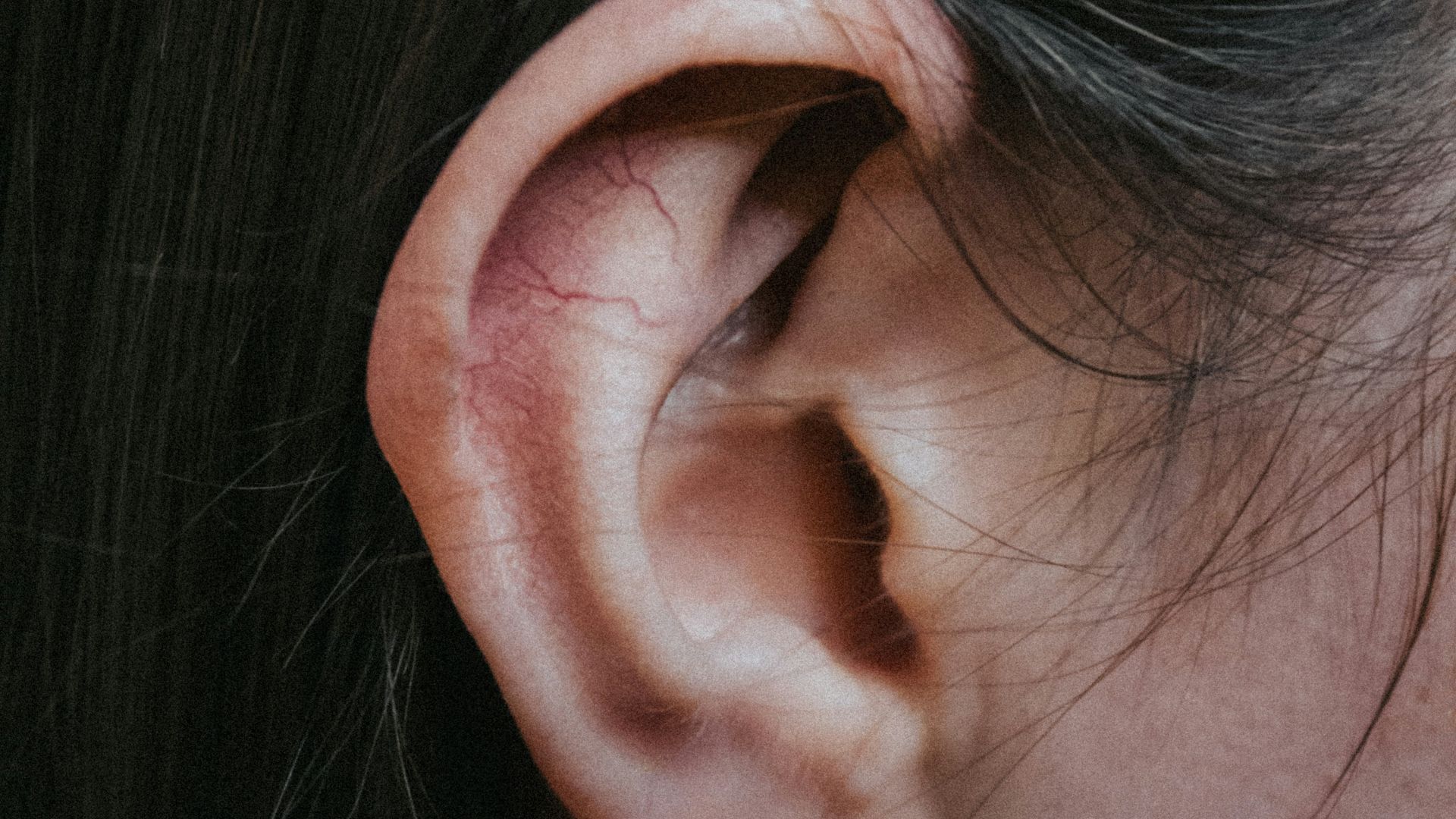 2. Le réflexe acoustique de l'étrier