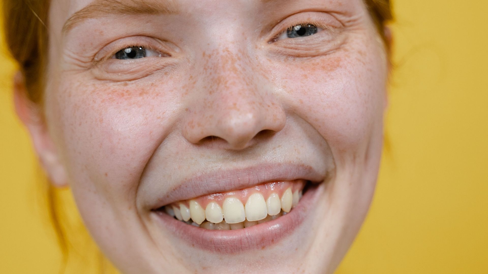 19. Un sourire qui donne du caractère