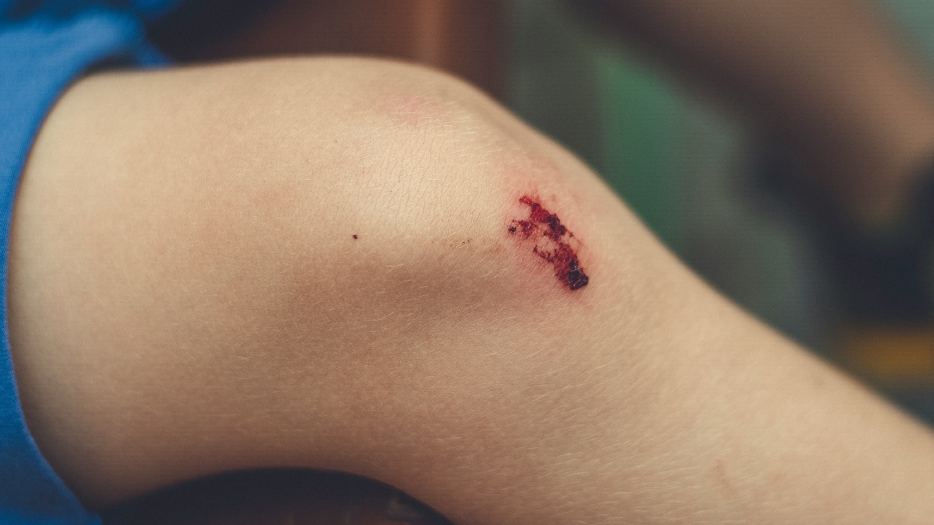 6. Plaies et coupures qui cicatrisent lentement
