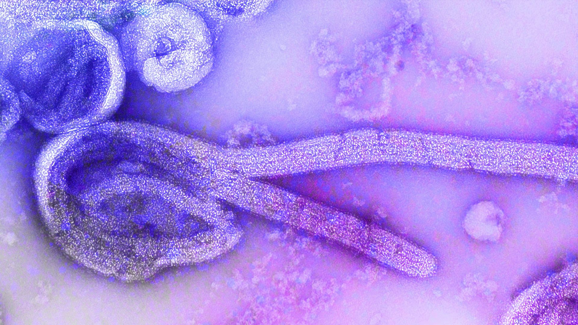 4. Votre corps abritait probablement des parasites