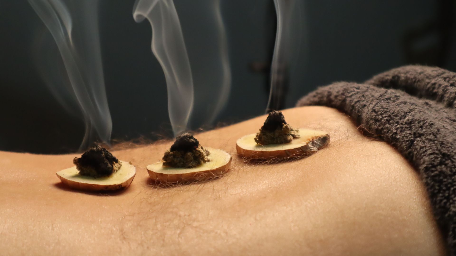 9. Moxibustion
