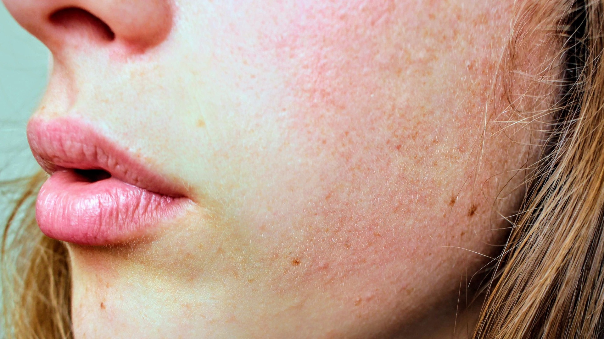8. Utilisation sur une peau lésée ou abîmée