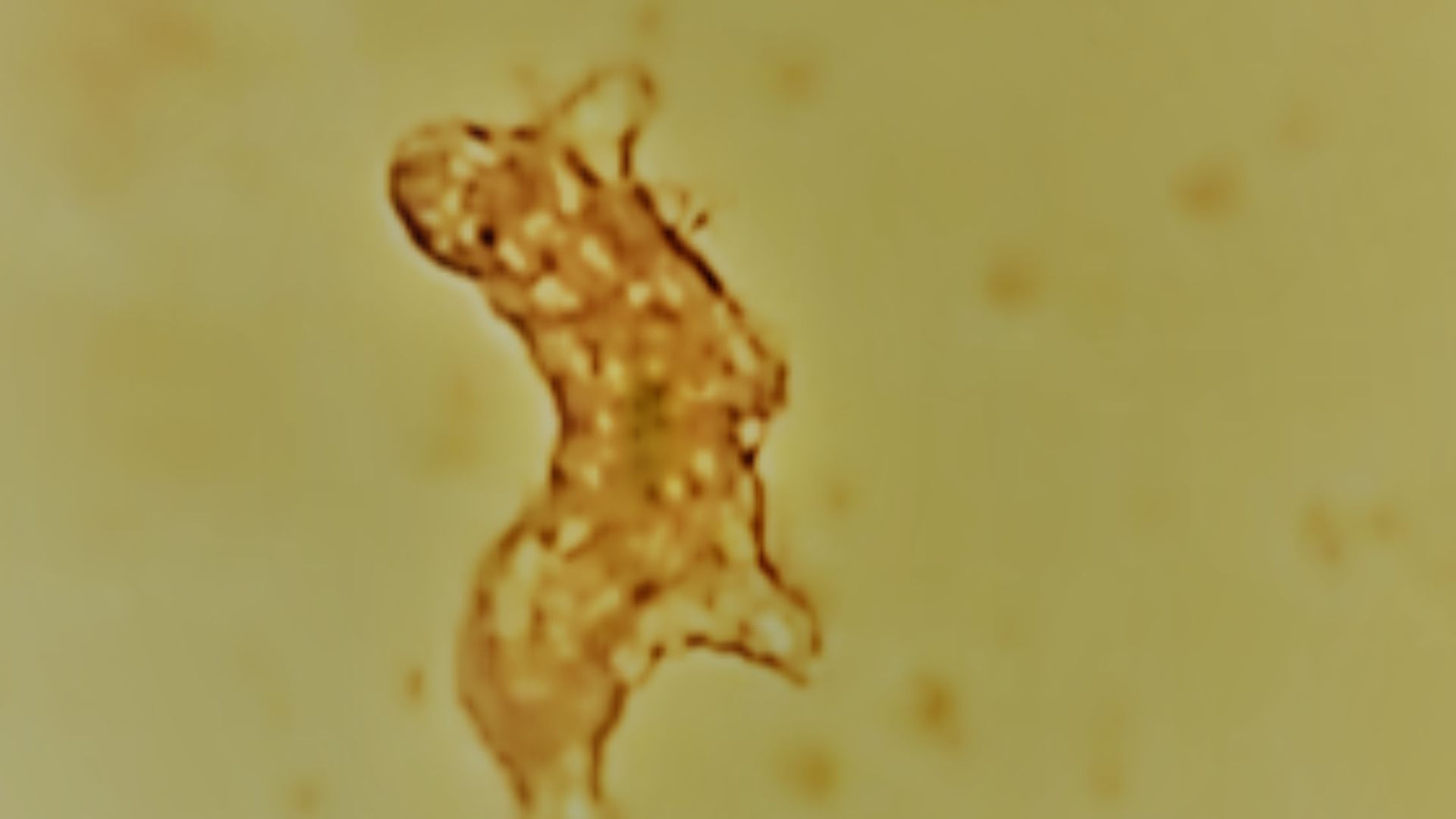 16. Tardigrade