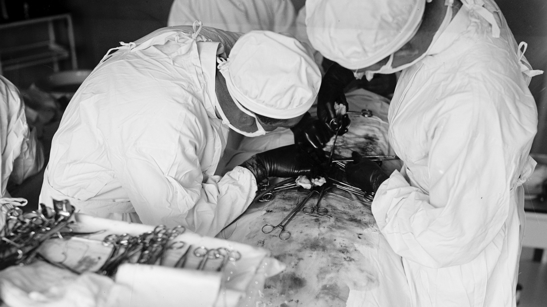 14. La chirurgie était jugée en fonction de la rapidité