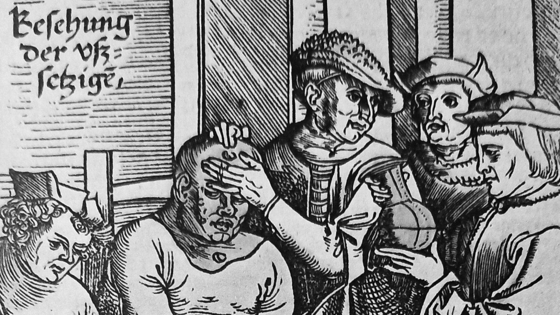 14. La lèpre était synonyme d'exil définitif