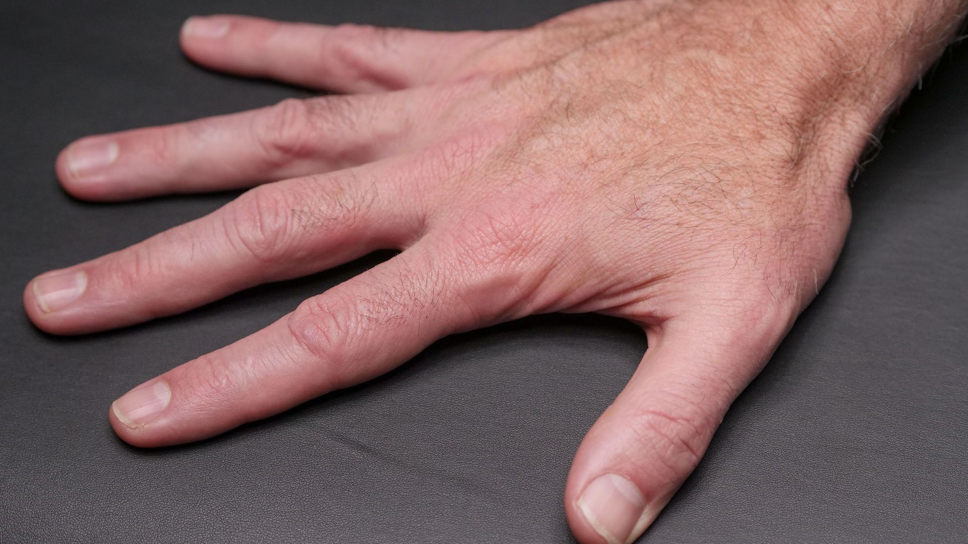 19. « 32 Feet Of Fingernails » de Melvin Boothe