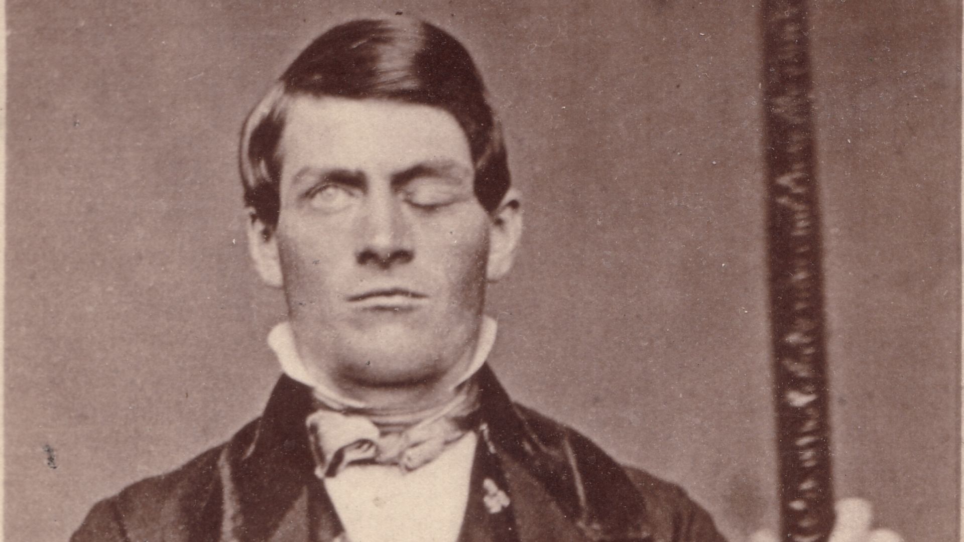 5. Le crâne de Phineas Gage