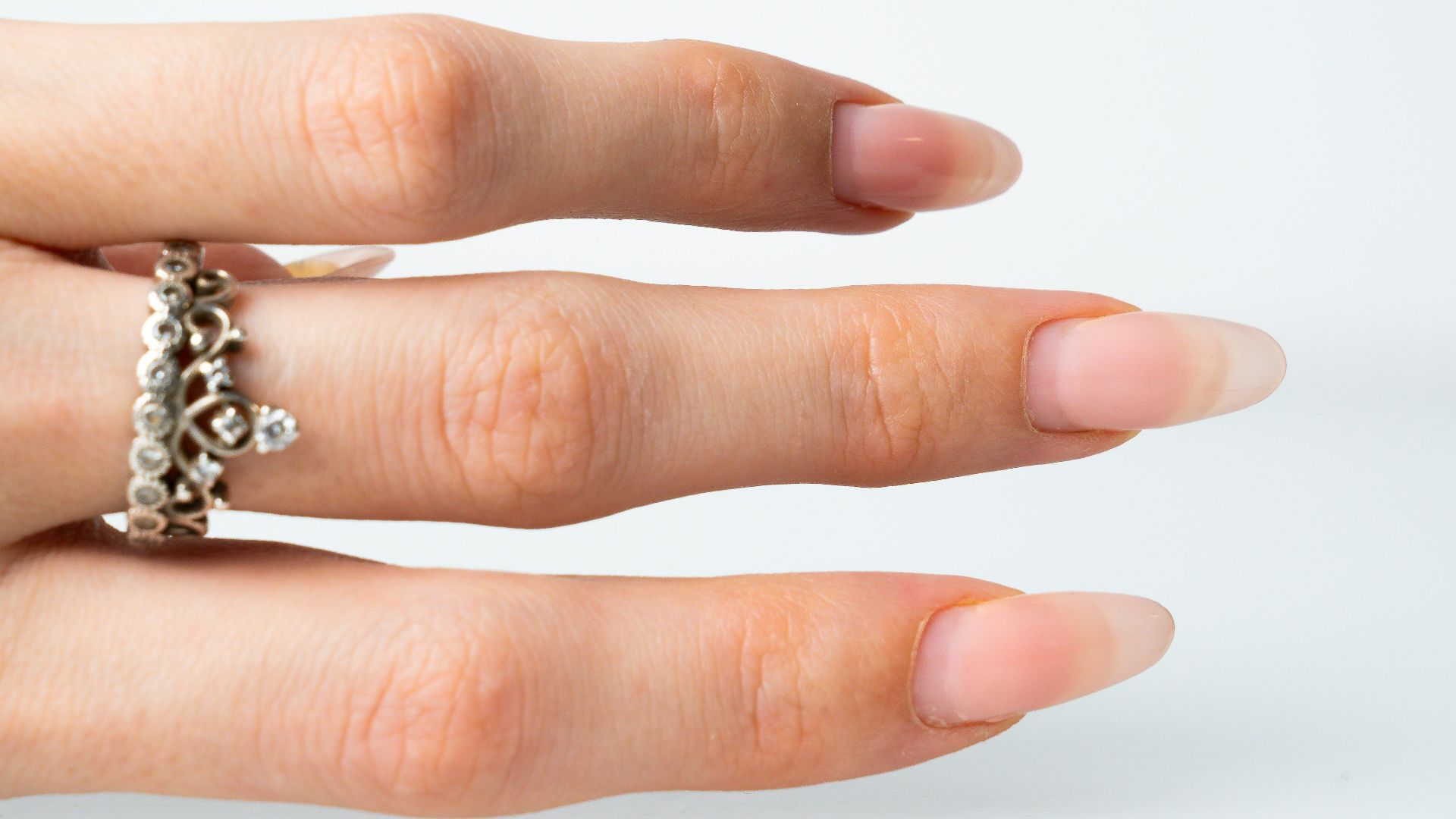 3. Les 28 pieds d'ongles de Lee Redmond