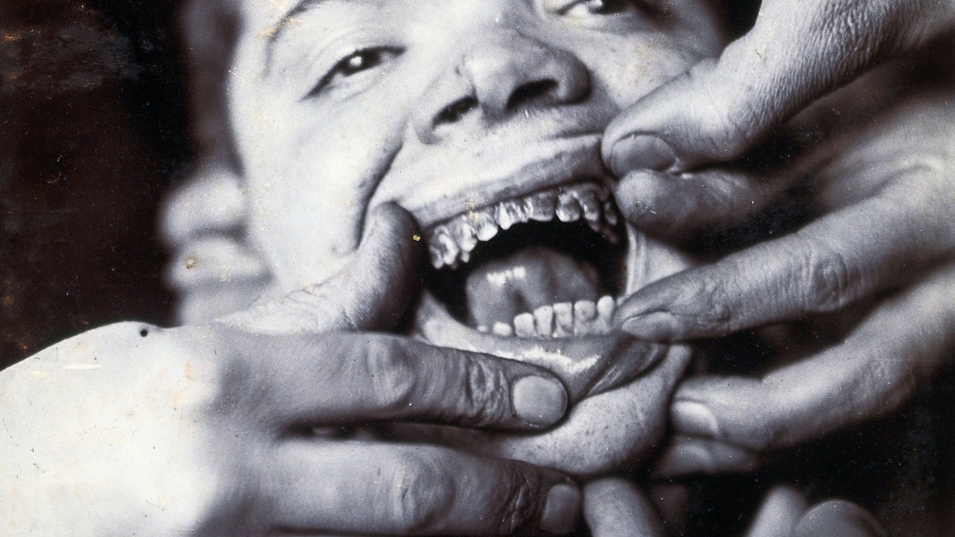 14. Des dents qui ont l'air abîmées, un symbole de statut social