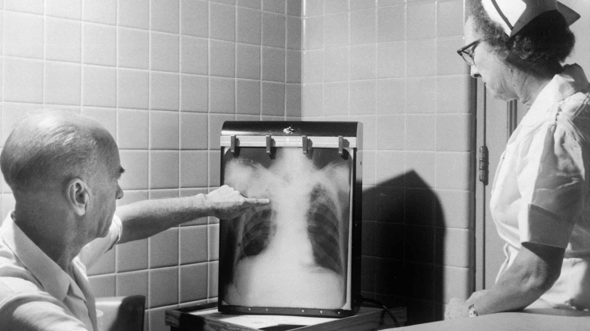 19. Les premiers patients et travailleurs exposés aux rayons X subissaient parfois de graves brûlures