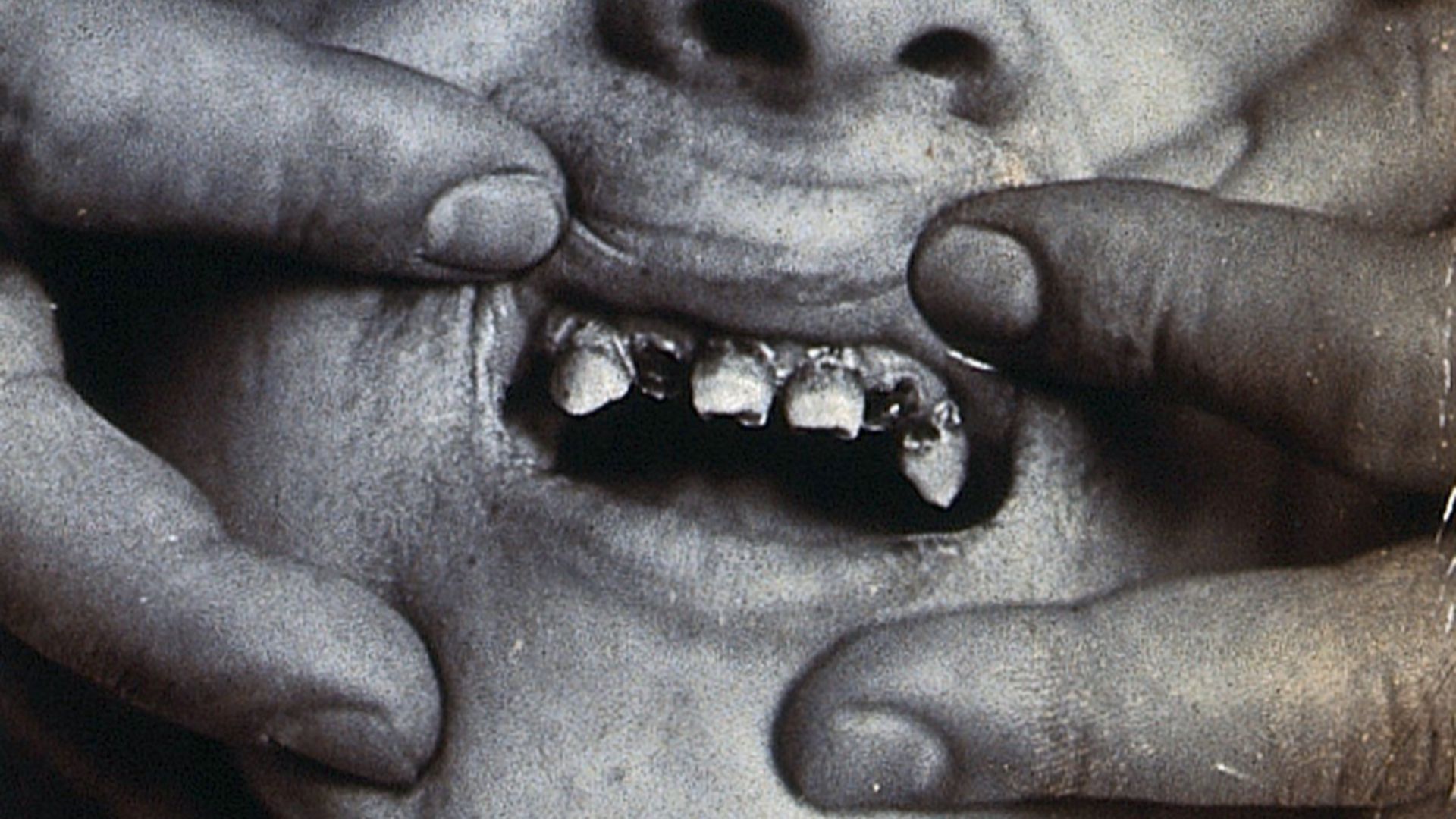 1. « Tes dents sont d'un noir magnifique »
