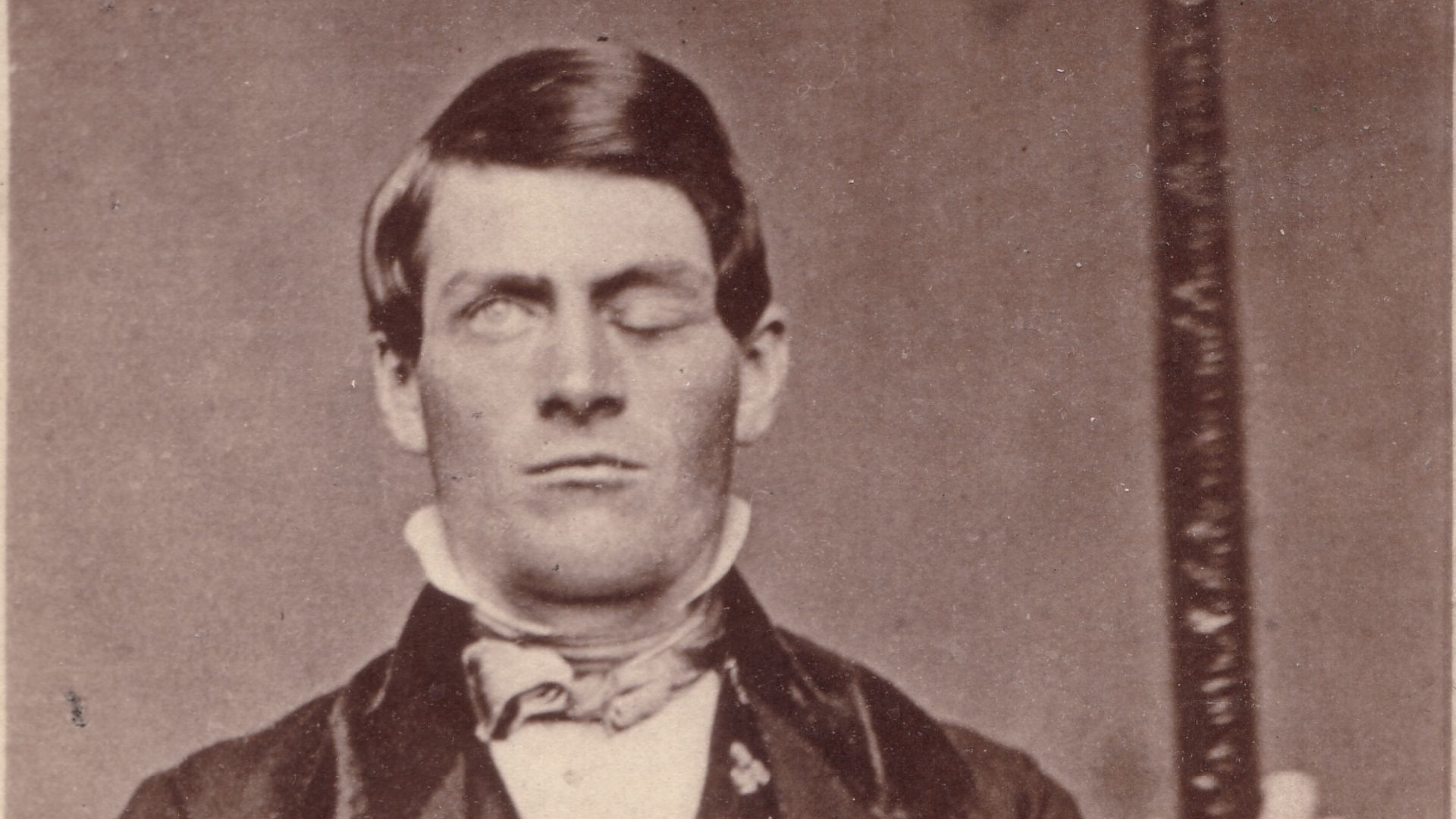 1. Phineas Gage