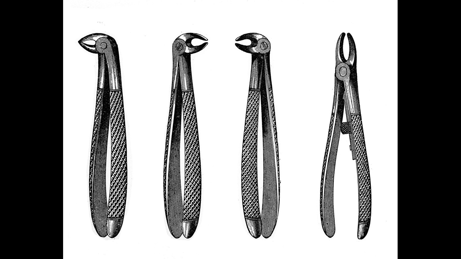 8. Electrified Dental Forceps Distracted Patients, Didn't Numb Them